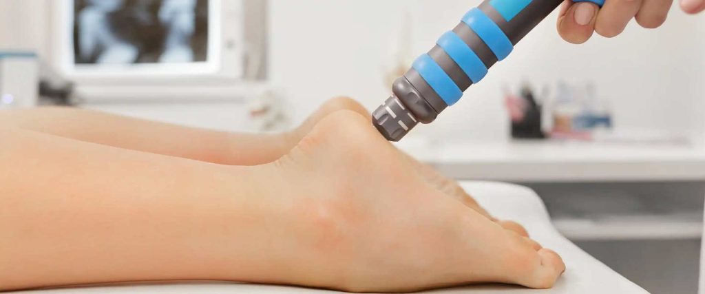 Shockwave Therapy for Plantar Fasciitis: A Breakthrough Approach to Chronic Pain Relief