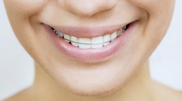 Retainers Monmouth County NJ