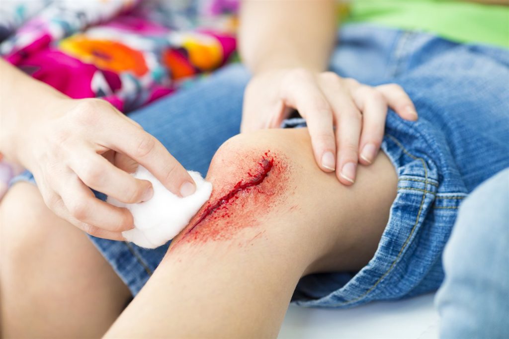 Pass on the peroxide: A surgeon’s guide to cleaning wounds at home Monmouth County NJ Parents Should Know..