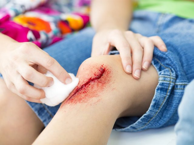 Pass on the peroxide: A surgeon’s guide to cleaning wounds at home Monmouth County NJ Parents Should Know..
