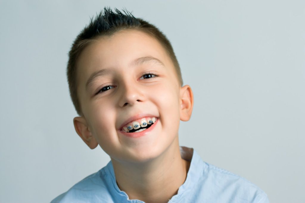 When Should Kids Get Braces? A Simple Guide for Monmouth County NJ Parents