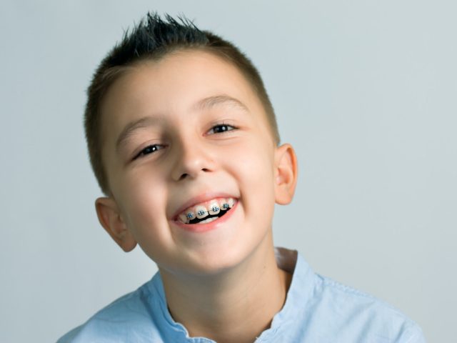 When Should Kids Get Braces? A Simple Guide for Monmouth County NJ Parents