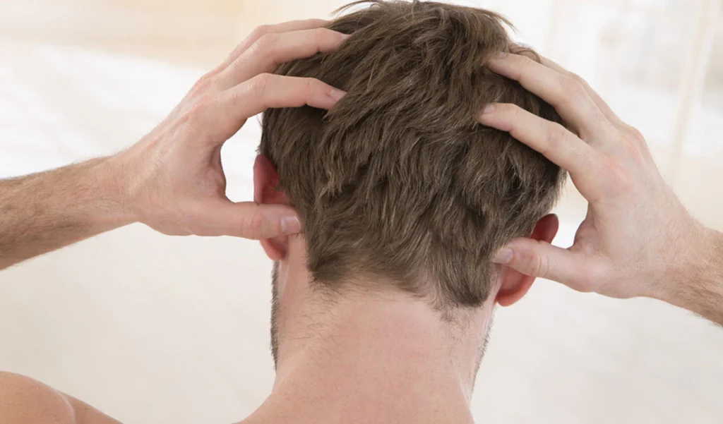 Tips For Monmouth County NJ Residents On How To Fight Flaky Scalp