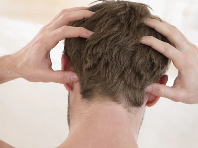 Tips For Monmouth County NJ Residents On How To Fight Flaky Scalp