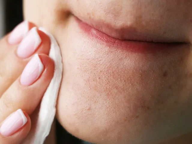 The Best and Worst Ways to Get Rid of Blackheads